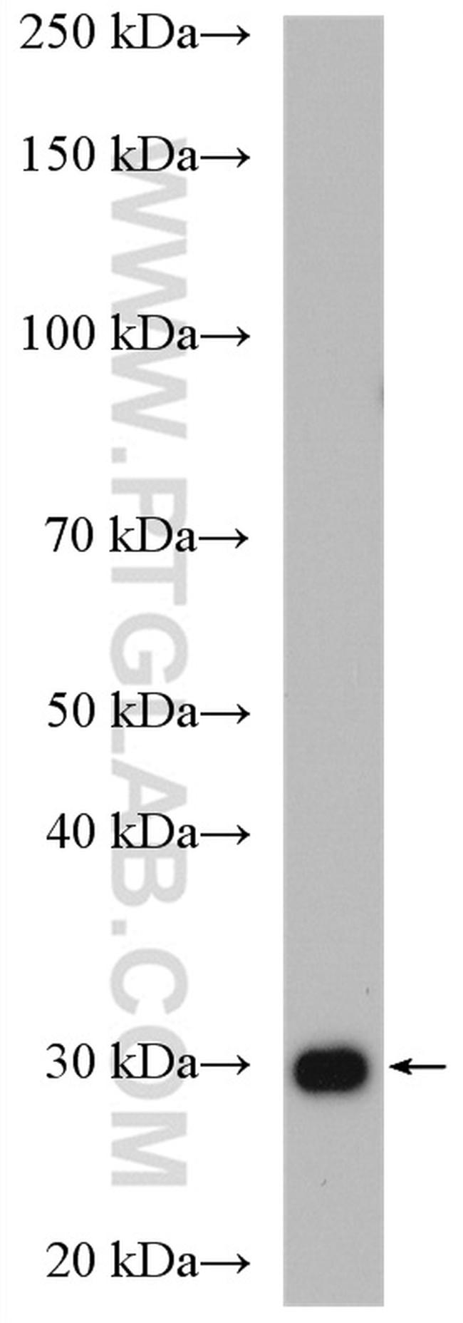 RPS3 Antibody in Western Blot (WB)