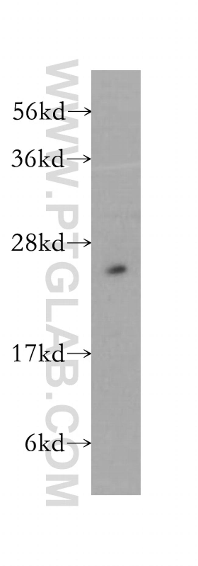 RPS3 Antibody in Western Blot (WB)