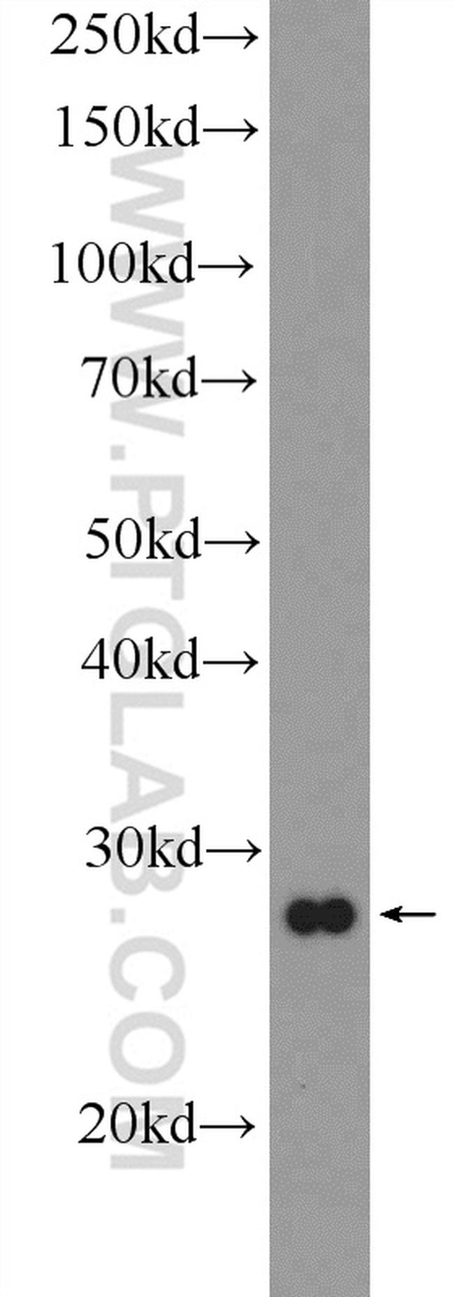 RPS3 Antibody in Western Blot (WB)