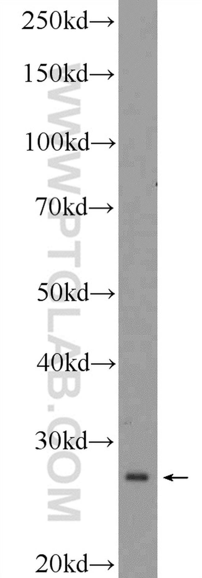 RPS3 Antibody in Western Blot (WB)