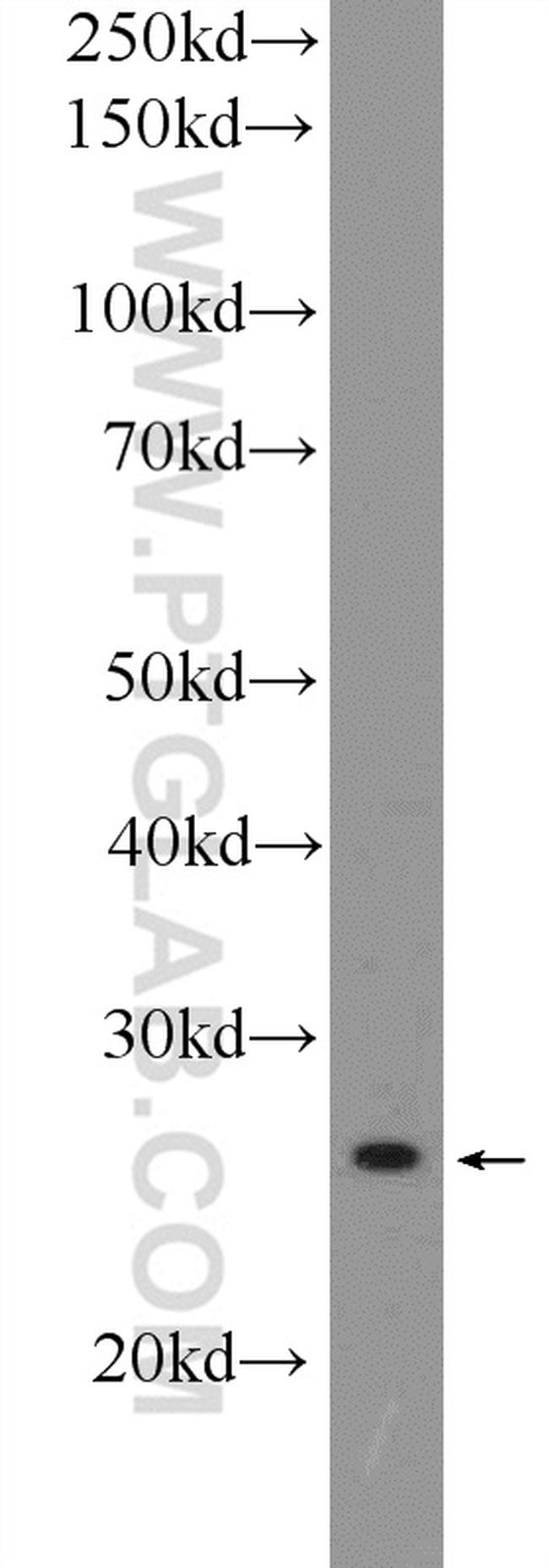 RPS3 Antibody in Western Blot (WB)