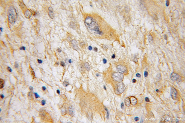 Galc Antibody in Immunohistochemistry (Paraffin) (IHC (P))