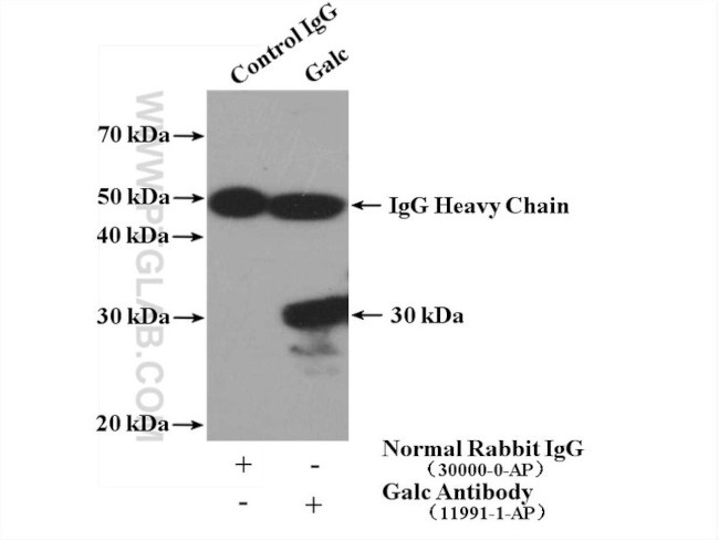 Galc Antibody in Immunoprecipitation (IP)