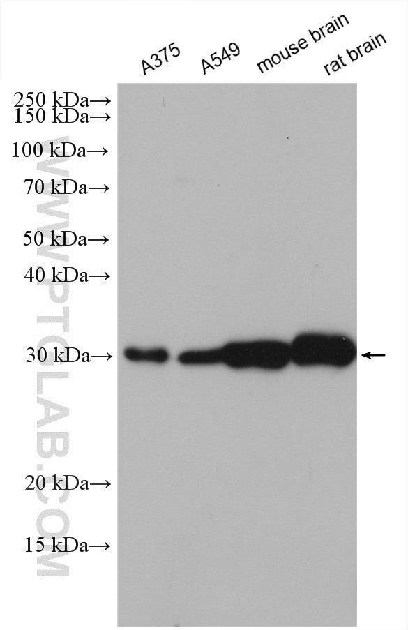 Galc Antibody in Western Blot (WB)