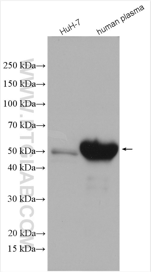 Angiotensinogen Antibody in Western Blot (WB)