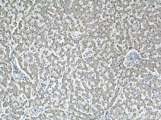 Angiotensinogen Antibody in Immunohistochemistry (Paraffin) (IHC (P))