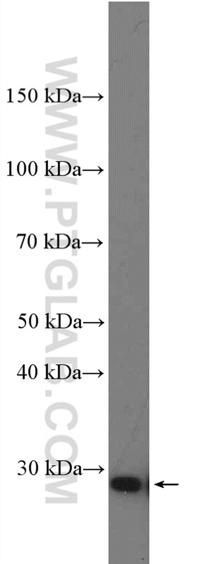 TCEAL1 Antibody in Western Blot (WB)