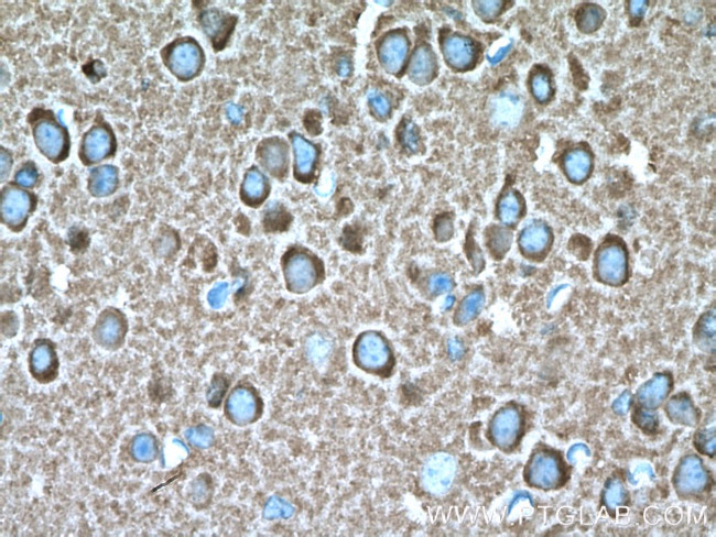 Glutamate receptor 2 Antibody in Immunohistochemistry (Paraffin) (IHC (P))