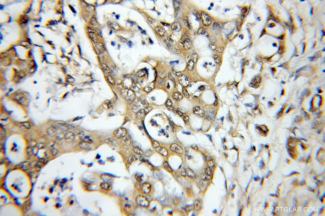 MLK3 Antibody in Immunohistochemistry (Paraffin) (IHC (P))