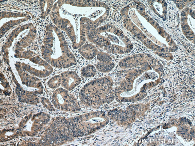 MLK3 Antibody in Immunohistochemistry (Paraffin) (IHC (P))