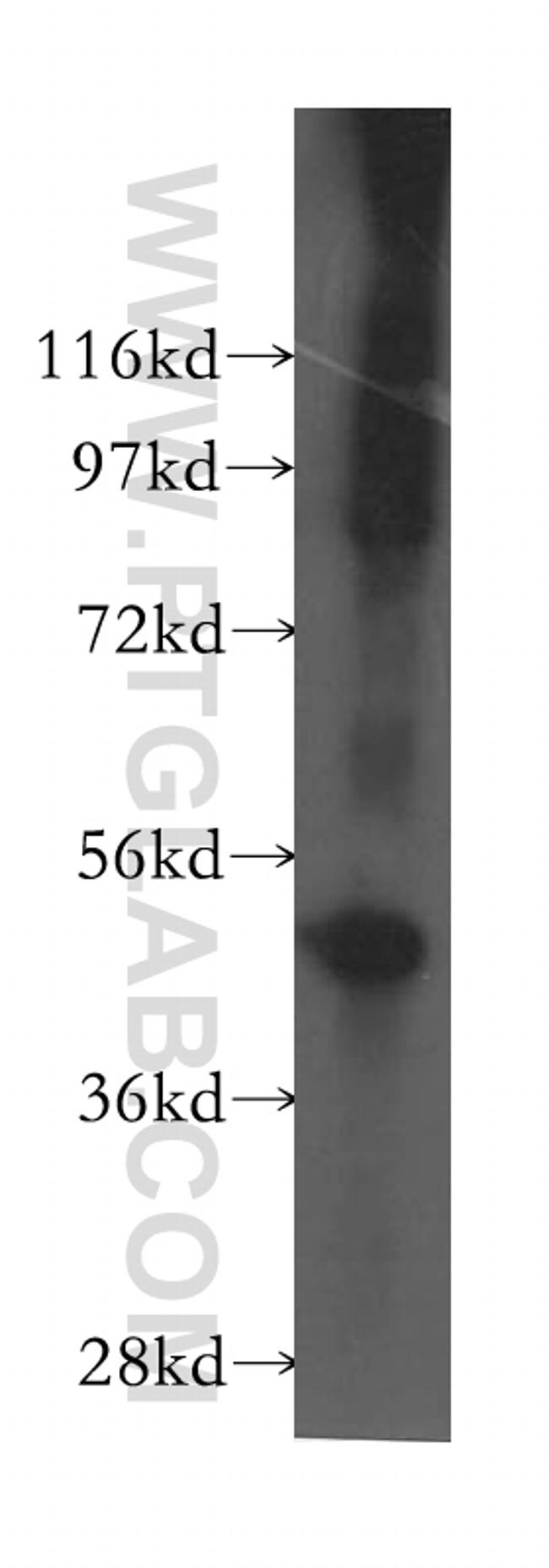 OLFM2 Antibody in Western Blot (WB)