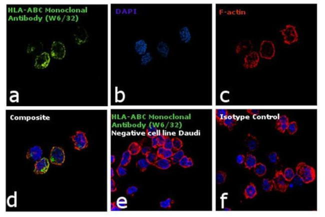 HLA-ABC Antibody