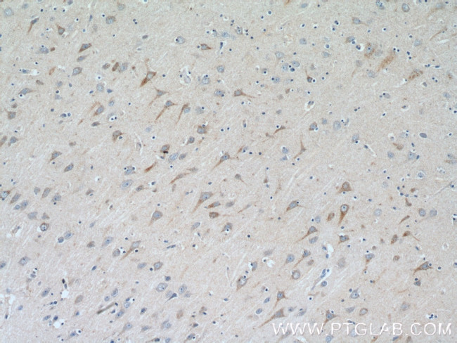 TrkC Antibody in Immunohistochemistry (Paraffin) (IHC (P))