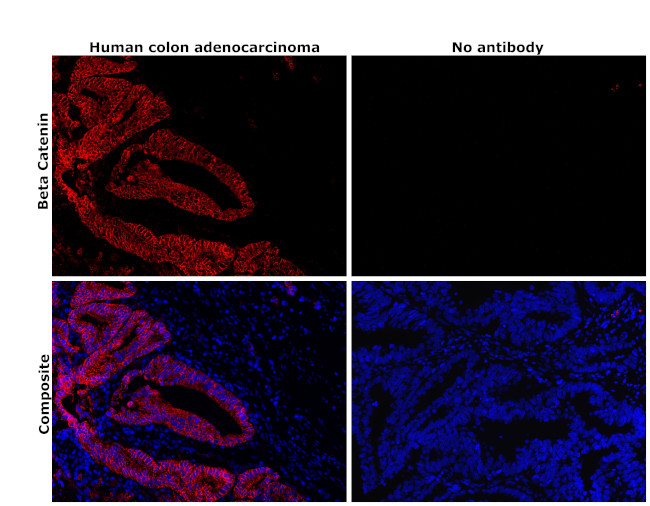 beta Catenin Antibody in Immunohistochemistry (Paraffin) (IHC (P))