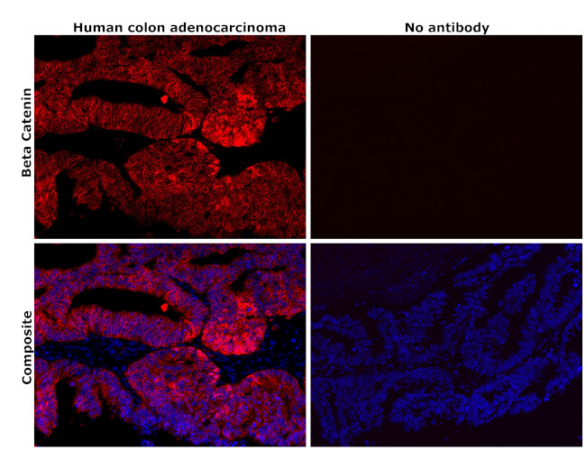 beta Catenin Antibody in Immunohistochemistry (Paraffin) (IHC (P))