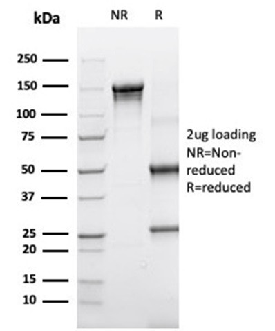 Alpha-1-Antichymotrypsin (SERPINA3) (Histiocytoma Marker) Antibody in SDS-PAGE (SDS-PAGE)