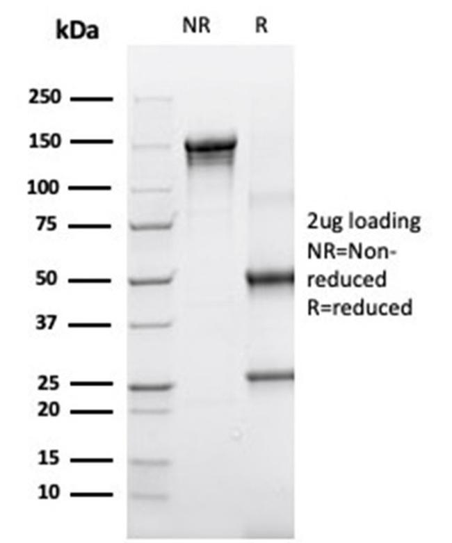 Alpha-1-Antichymotrypsin (SERPINA3) (Histiocytoma Marker) Antibody in Immunoelectrophoresis (IE)