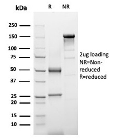 Alpha-1-Antichymotrypsin (SERPINA3) (Histiocytoma Marker) Antibody in SDS-PAGE (SDS-PAGE)