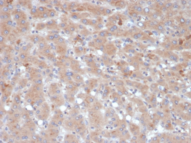 Alpha-1-Antichymotrypsin (SERPINA3) (Histiocytoma Marker) Antibody in Immunohistochemistry (Paraffin) (IHC (P))