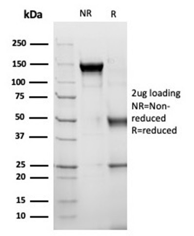 Alpha-1-Antichymotrypsin (SERPINA3) (Histiocytoma Marker) Antibody in SDS-PAGE (SDS-PAGE)