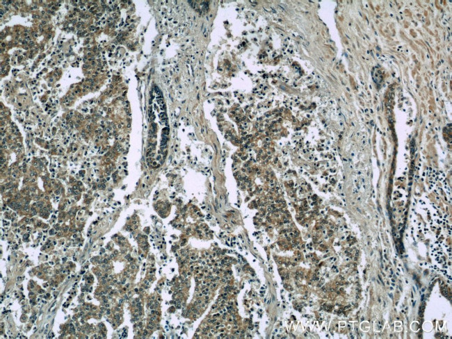 EFEMP2 Antibody in Immunohistochemistry (Paraffin) (IHC (P))