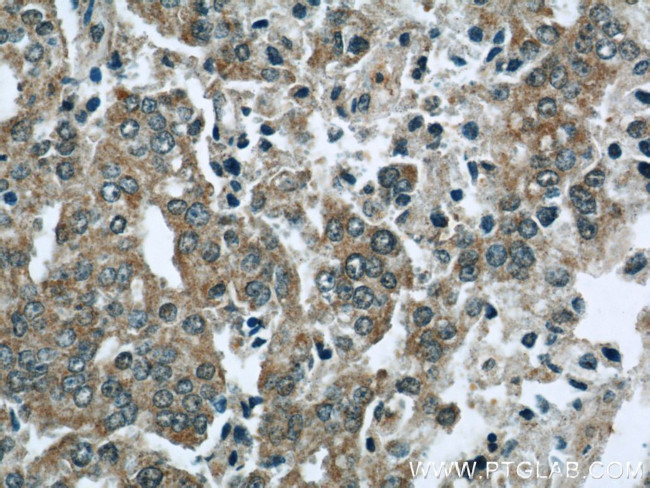 EFEMP2 Antibody in Immunohistochemistry (Paraffin) (IHC (P))