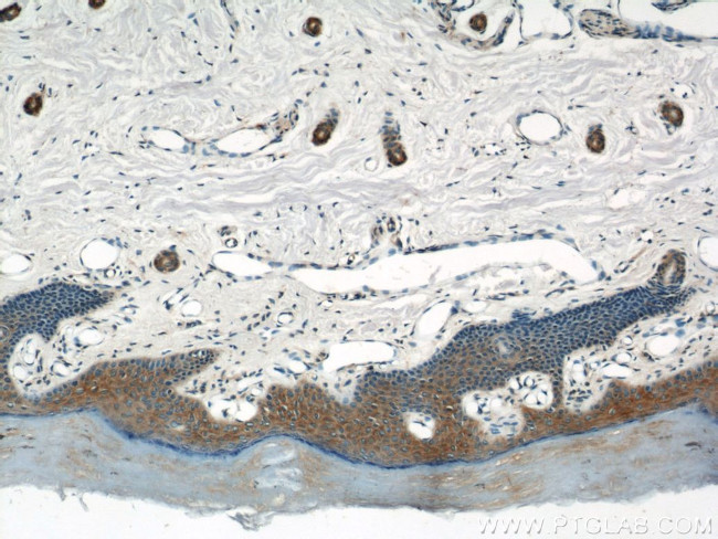 EFEMP2 Antibody in Immunohistochemistry (Paraffin) (IHC (P))