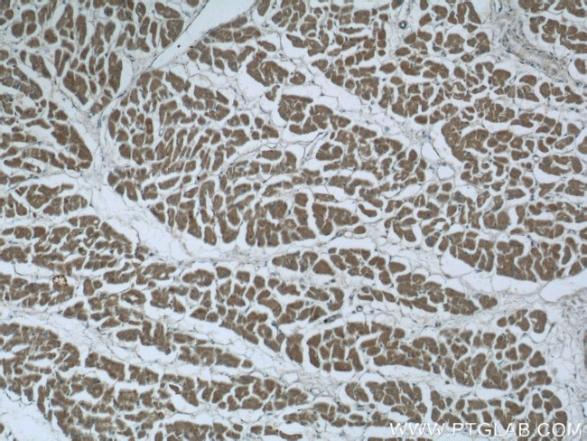 EFEMP2 Antibody in Immunohistochemistry (Paraffin) (IHC (P))