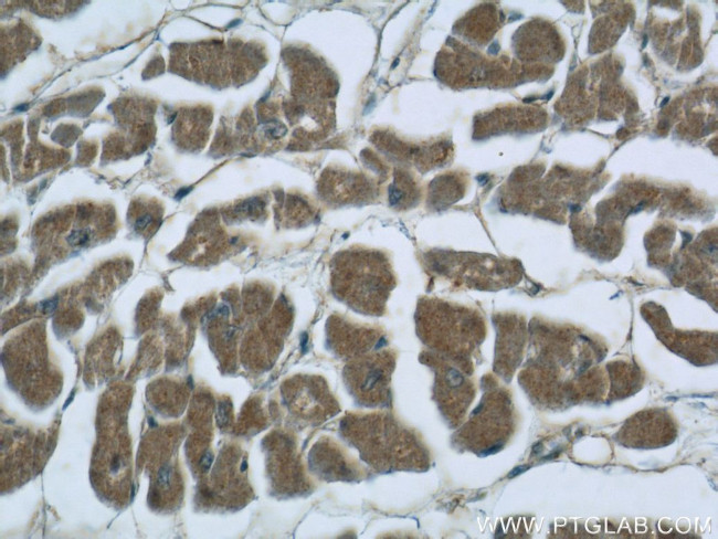 EFEMP2 Antibody in Immunohistochemistry (Paraffin) (IHC (P))