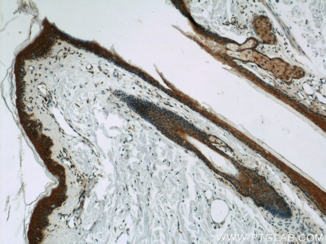 EFEMP2 Antibody in Immunohistochemistry (Paraffin) (IHC (P))