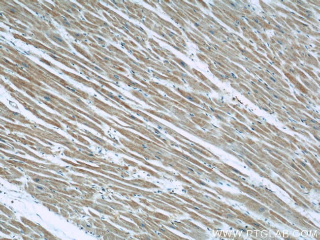 EFEMP2 Antibody in Immunohistochemistry (Paraffin) (IHC (P))