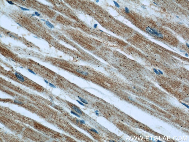 EFEMP2 Antibody in Immunohistochemistry (Paraffin) (IHC (P))