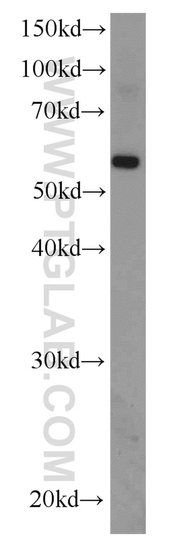 EFEMP2 Antibody in Western Blot (WB)