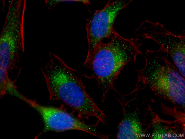 VPS45 Antibody in Immunocytochemistry (ICC/IF)