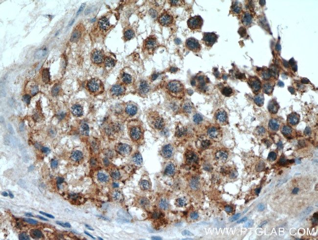 VPS45 Antibody in Immunohistochemistry (Paraffin) (IHC (P))