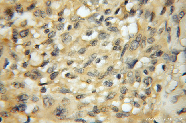 VPS45 Antibody in Immunohistochemistry (Paraffin) (IHC (P))