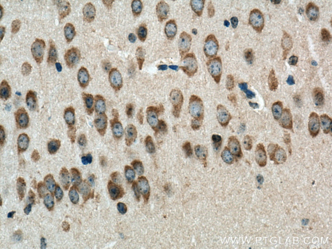 VPS45 Antibody in Immunohistochemistry (Paraffin) (IHC (P))