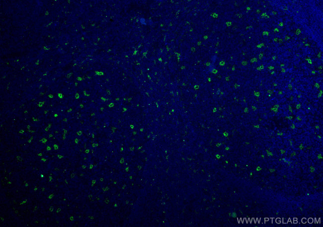 TIMD4 Antibody in Immunohistochemistry (PFA fixed) (IHC (PFA))