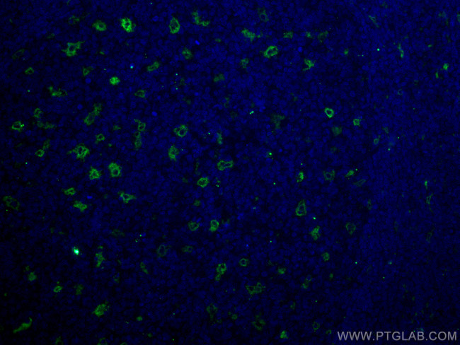 TIMD4 Antibody in Immunohistochemistry (PFA fixed) (IHC (PFA))