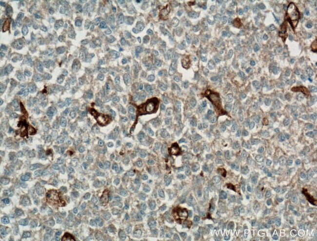 TIMD4 Antibody in Immunohistochemistry (Paraffin) (IHC (P))