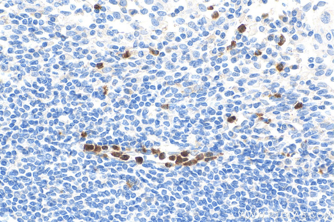 CAMP Antibody in Immunohistochemistry (Paraffin) (IHC (P))