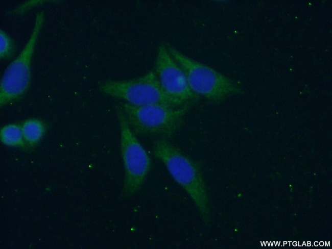 CAMP Antibody in Immunocytochemistry (ICC/IF)