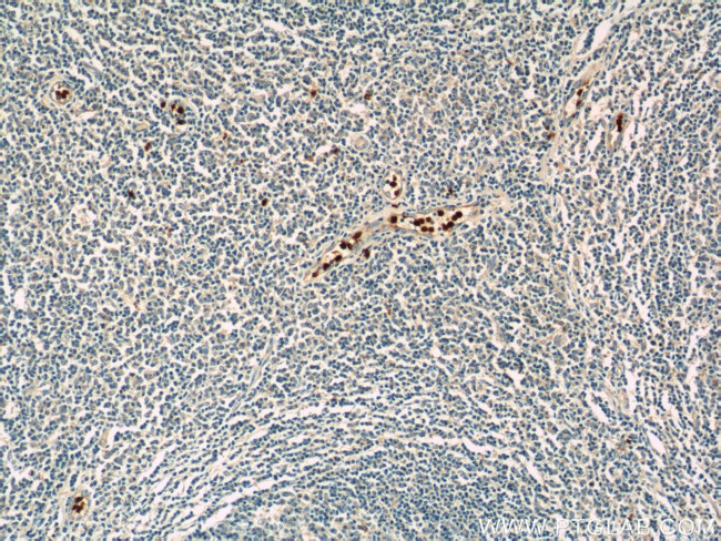 CAMP Antibody in Immunohistochemistry (Paraffin) (IHC (P))