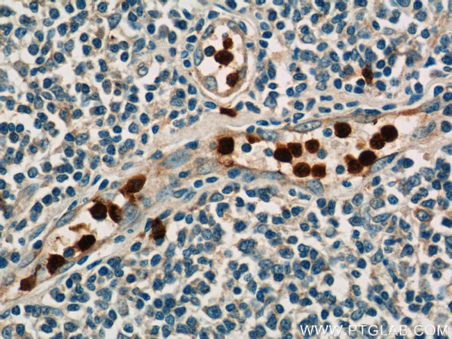 CAMP Antibody in Immunohistochemistry (Paraffin) (IHC (P))