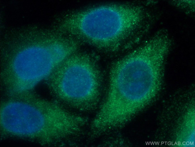 SERPINA6 Antibody in Immunocytochemistry (ICC/IF)