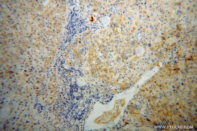 SERPINA6 Antibody in Immunohistochemistry (Paraffin) (IHC (P))