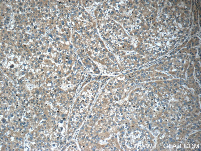 SERPINA6 Antibody in Immunohistochemistry (Paraffin) (IHC (P))