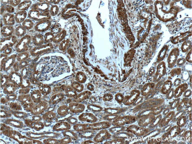 SERPINA6 Antibody in Immunohistochemistry (Paraffin) (IHC (P))