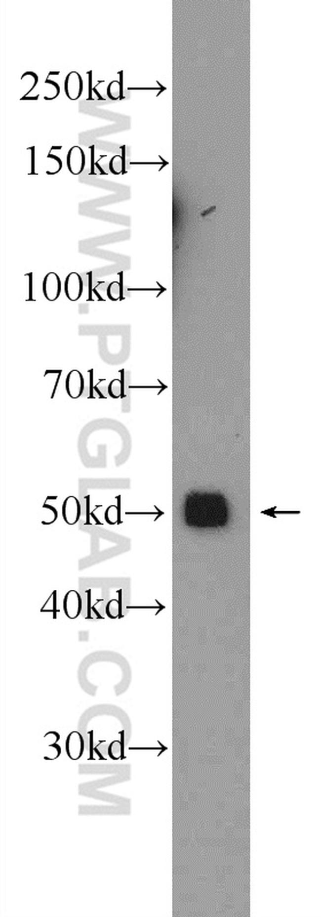 SERPINA6 Antibody in Western Blot (WB)