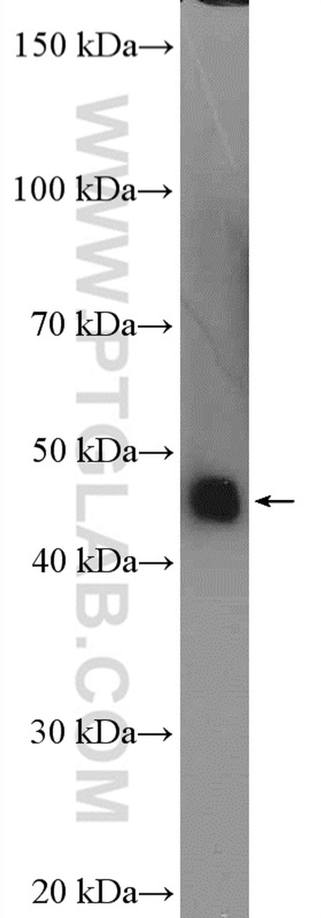 SERPINA6 Antibody in Western Blot (WB)